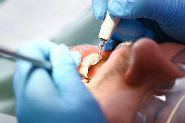 Best Emergency Treatment for Toothache in Imlay City, MI