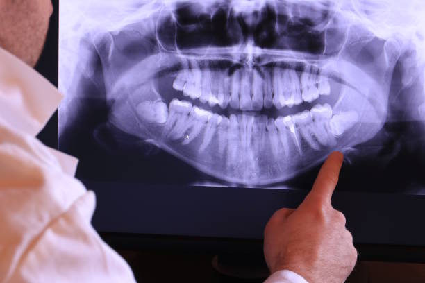 Best Pediatric Emergency Dentist in Imlay City, MI